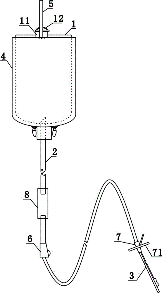 易定位的灌肠装置的制造方法附图