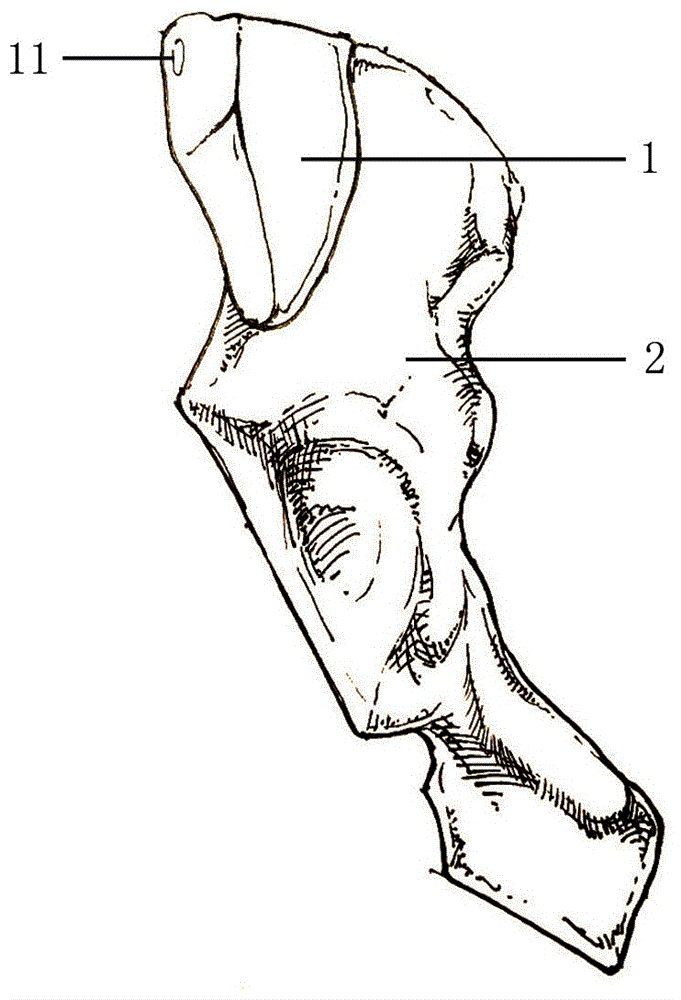 骨盆前环骨折闭合复位置钉导向装置的制造方法附图