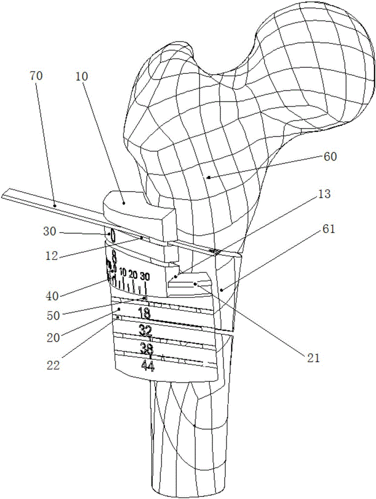精准测量型旋转截骨导板的制作方法附图