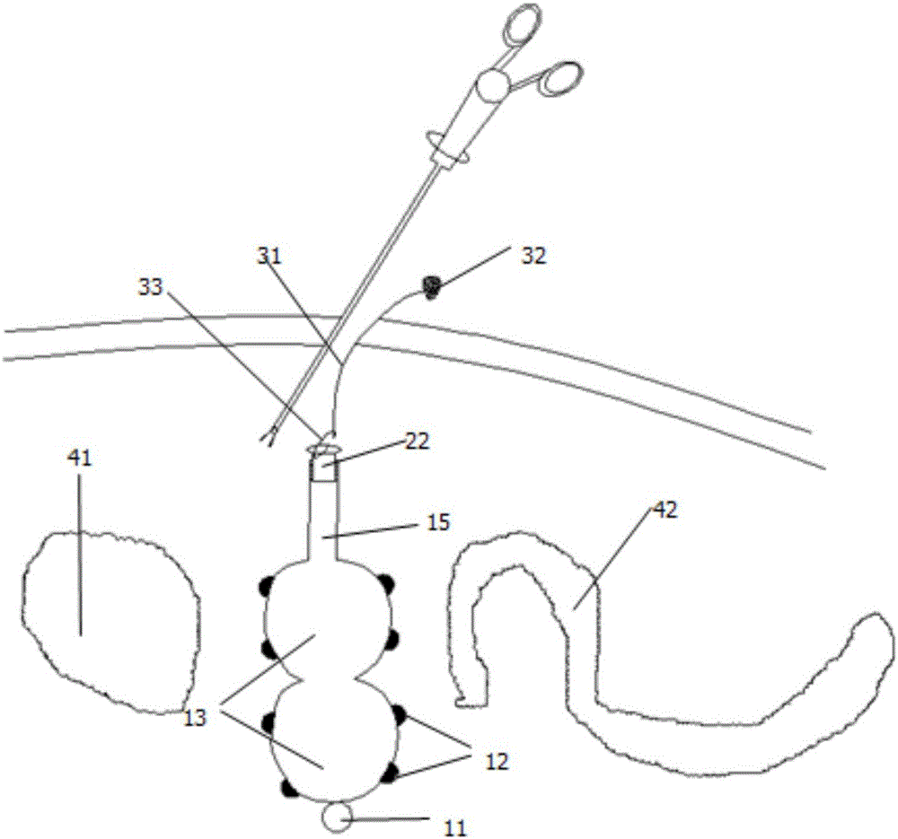 一种腹腔镜手术用的水囊肠垫的制作方法附图